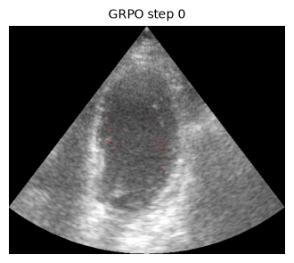 RAU segmentation prediction evolving over real GRPO steps