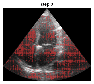 RAU segmentation prediction evolving over real training steps